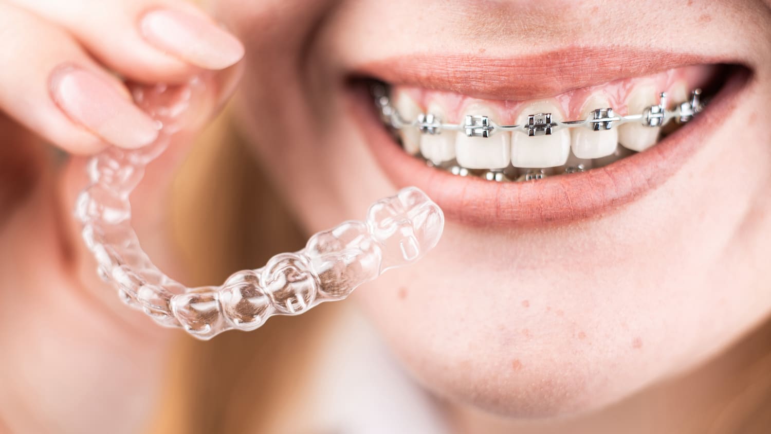 Orthodontie